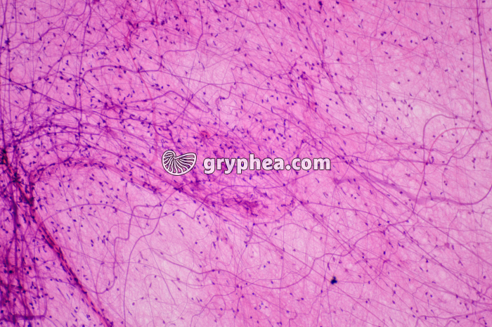 Réseau fibres nerveuses ME x40 - gryphea.com